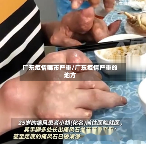 广东疫情哪市严重/广东疫情严重的地方-第2张图片