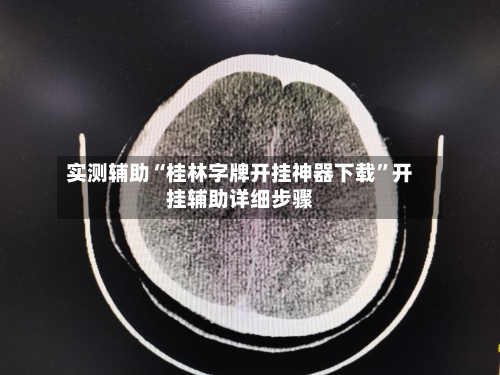 实测辅助“桂林字牌开挂神器下载”开挂辅助详细步骤-第2张图片