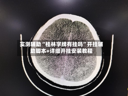 实测辅助“桂林字牌有挂吗”开挂辅助脚本+详细开挂安装教程