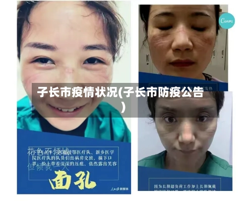 子长市疫情状况(子长市防疫公告)-第2张图片